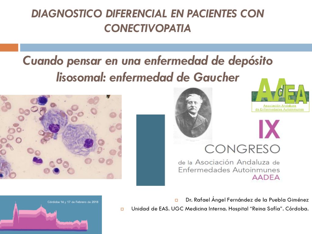 enfermedad de Gaucher tipo 1 incidencia de diabetes enfermedad de Gaucher tipo 1 incidencia de diabetes